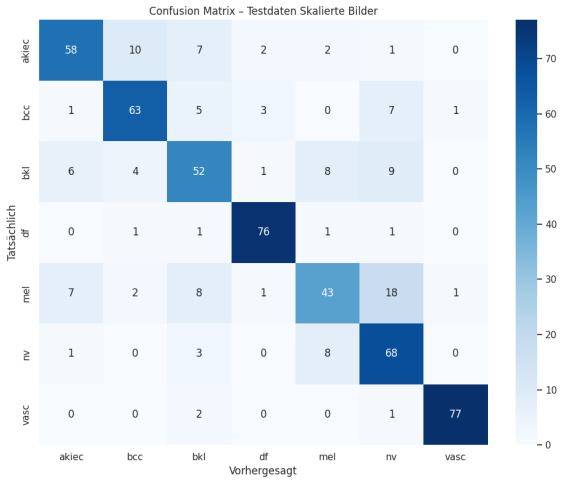 Konfusionsmatrix für die vom SRGAN hochskalierten Bilder
