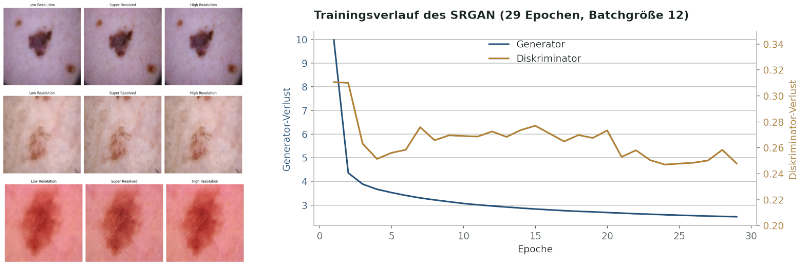 Links dasselbe Bild in niedriger Auflösung, vom SRGAN hochskaliert und in echter hoher Auflösung; rechts der Verlauf von Generator- und Diskriminatorverlust über 29 Trainingsepochen